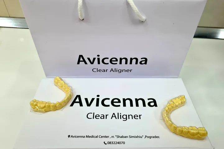 Avicenna Clear Aligner